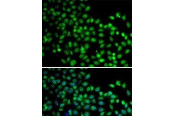 FKBP6 antibody