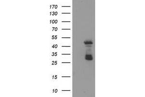 HEK293T cells were transfected with the pCMV6-ENTRY control (Left lane) or pCMV6-ENTRY ELK3 (Right lane) cDNA for 48 hrs and lysed. (ELK3 antibody)