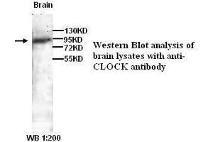 Image no. 1 for anti-Clock Homolog (Mouse) (CLOCK) antibody (ABIN790960) (CLOCK antibody)