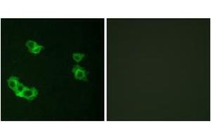 Immunofluorescence analysis of MCF7 cells, using PTHR1 Antibody. (PTH1R antibody  (AA 145-194))