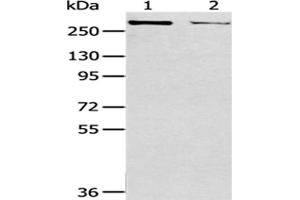 Gel: 6 % SDS-PAGE,Lysate: 40 μg,Lane 1-2: MCF7 cells, Hela cells,Primary antibody: ABIN7193051(WNK2 Antibody) at dilution 1/200 dilution,Secondary antibody: Goat anti rabbit IgG at 1/8000 dilution,Exposure time: 10 minutes (WNK2 antibody)