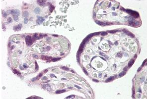 Placenta (DLX3 antibody  (N-Term))