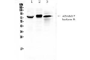 Western blot analysis of ADAM17 using anti-ADAM17 antibody . (ADAM17 antibody  (AA 215-433))