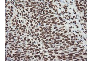 Image no. 10 for anti-F-Box Protein 21 (FBXO21) antibody (ABIN1498233) (FBXO21 antibody)