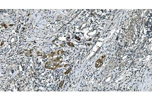 IHC analysis of CDC123 using anti-CDC123 antibody (ABIN7599284). (CDC123 antibody  (AA 1-336))