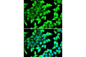 Immunofluorescence analysis of A549 cell using HDAC5 antibody.