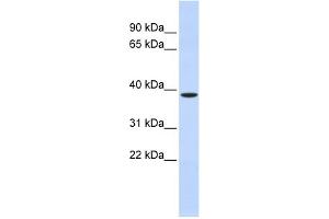WB Suggested Anti-ZFPL1 Antibody Titration: 0. (ZFPL1 antibody  (Middle Region))