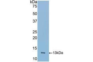 Detection of Recombinant ICOS, Mouse using Polyclonal Antibody to Inducible T-Cell Co Stimulator (ICOS) (ICOS antibody  (AA 35-131))