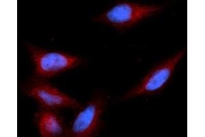 Immunofluorescence (IF) image for anti-Fatty Acid Binding Protein 7, Brain (FABP7) (AA 1-132) antibody (PE) (ABIN5566686)