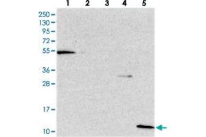 Western blot analysis of Lane 1: RT-4, Lane 2: U-251 MG, Lane 3: Human Plasma, Lane 4: Liver, Lane 5: Tonsil with CRIP1 polyclonal antibody . (CRIP1 antibody)