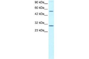 WB Suggested Anti-OSR2 Antibody Titration: 0. (OSR2 antibody  (N-Term))