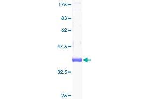 CSTF3 Protein (AA 1-103) (GST tag)