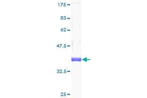 CSTF3 Protein (AA 1-103) (GST tag)