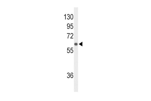 SLCO1B1 antibody  (AA 267-293)