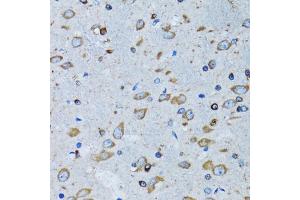 Immunohistochemistry of paraffin-embedded mouse brain using RARS antibody (ABIN5973728) at dilution of 1/100 (40x lens). (RARS antibody)