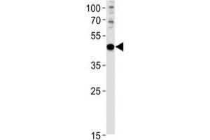 PAX6 antibody western blot analysis in U251 lysate (PAX6 antibody  (AA 183-210))