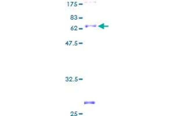 ARG2 Protein (AA 1-354) (GST tag)