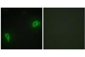 Immunofluorescence analysis of HepG2 cells, using DOK7 antibody. (DOK7 antibody  (N-Term))