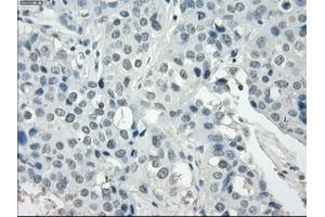 Image no. 1 for anti-Synovial Sarcoma, X Breakpoint 2 (SSX2) antibody (ABIN1501162)