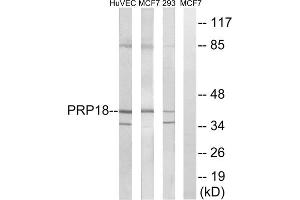 Western blot analysis of extracts from HuvEc cells, MCF-7 cells and 293 cells, using PRPF18 antibody. (PRPF18 antibody  (Internal Region))