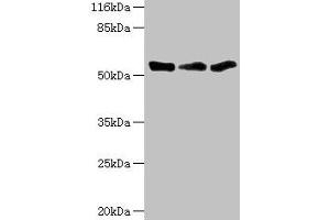 Western blot All lanes: TFCP2 antibody at 1.