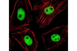 Immunofluorescence (IF) image for anti-Enhancer of Zeste Homolog 2 (EZH2) antibody (ABIN3028636)