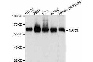 Western blot analysis of extracts of various cell lines, using NARS antibody. (NARS antibody  (AA 309-548))