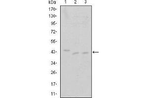 Western blot analysis using CDK9 mouse mAb against Jurkat (1), A431 (2) and HEK293 (3) cell lysate. (CDK9 antibody)