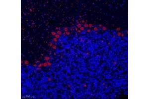 Immunofluorescence of paraffin embedded rat cerebellum using NOVA2 (ABIN7074810) at dilution of 1: 200 (200x lens) (NOVA2 antibody)