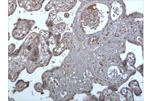 Immunohistochemistry (IHC) image for anti-Triggering Receptor Expressed On Myeloid Cells 1 (TREM1) (AA 21-205) antibody (ABIN1983467) (TREM1 antibody  (AA 21-205))