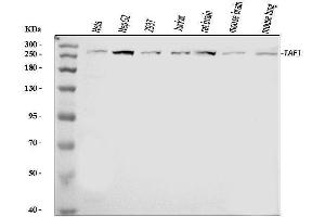 Western blot analysis of TAF1 using anti-TAF1 antibody (ABIN7599995).
