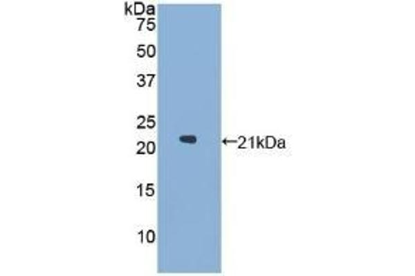 GAA Antikörper  (AA 595-770)