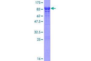 STK17A Protein (AA 1-414) (GST tag)