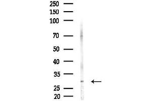 anti-Hepatoma-Derived Growth Factor-Related Protein 3 (HDGFRP3) (Internal Region) antibody