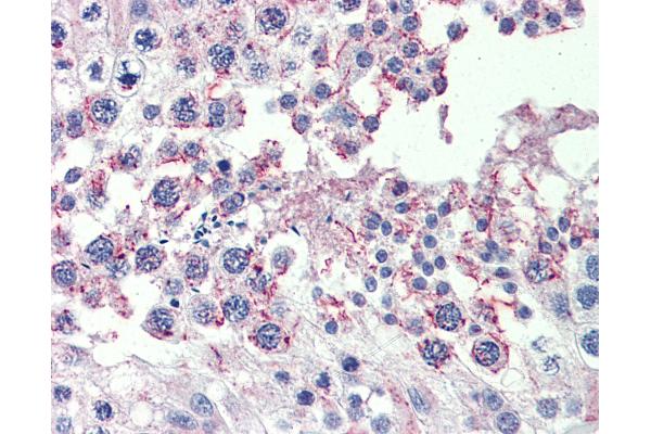 CPXCR1 antibody  (AA 396-445)