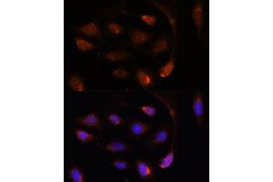 Immunofluorescence analysis of U-2 OS cells using SH3BGRL antibody (ABIN7270277) at dilution of 1:100. (SH3BGRL antibody  (AA 1-114))