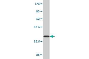 Western Blot detection against Immunogen (36. (NAGLU antibody  (AA 644-742))