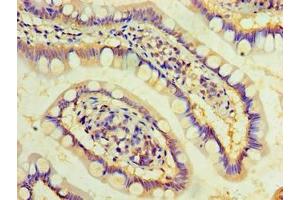 Immunohistochemistry of paraffin-embedded human small intestine tissue using ABIN7149484 at dilution of 1:100 (DAND5 antibody  (AA 23-189))