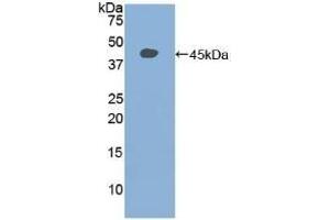 Detection of Recombinant STAT3, Rat using Polyclonal Antibody to Signal Transducer And Activator Of Transcription 3 (STAT3)