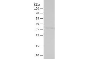 Western Blotting (WB) image for Histone Cluster 1, H1c (HIST1H1C) (AA 28-130) protein (His-IF2DI Tag) (ABIN7282329) (HIST1H1C Protein (AA 28-130) (His-IF2DI Tag))