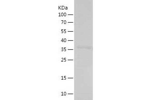 HIST1H1C Protein (AA 28-130) (His-IF2DI Tag)