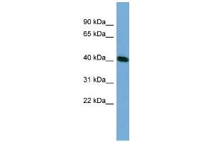 WB Suggested Anti-TSSK2 Antibody Titration: 0. (TSSK2 antibody  (Middle Region))