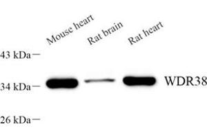 Western blot analysis of WDR38 (ABIN7076218) at dilution of 1: 2000 (WDR38 antibody)