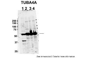 Sample Type: 1. (TUBA4A antibody  (Middle Region))