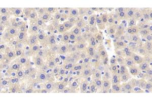Detection of SULT1A1 in Rat Liver Tissue using Polyclonal Antibody to Sulfotransferase 1A1 (SULT1A1) (SULT1A1 antibody  (AA 3-291))