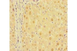 Immunohistochemistry of paraffin-embedded human liver tissue using ABIN7154596 at dilution of 1:100 (RIT1 antibody  (AA 1-219))