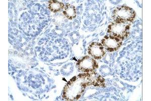 Image no. 1 for anti-Eukaryotic Translation Initiation Factor 2-alpha Kinase 2 (EIF2AK2) (C-Term) antibody (ABIN6735902)