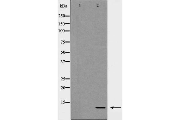 CXCL1 antibody  (Internal Region)