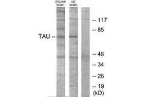 Western blot analysis of extracts from mouse brain/Rat brain cells, using Tau (Ab-356) Antibody. (tau antibody  (AA 641-690))