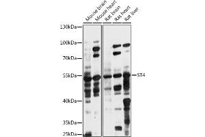 Western blot analysis of extracts of various cell lines, using 5T4 antibody (ABIN7271010) at 1:1000 dilution. (TPBG antibody  (AA 32-350))